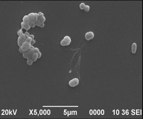 Scanning Electron Microscopy (SEM) image of Bacterial sample at 5000X magnification