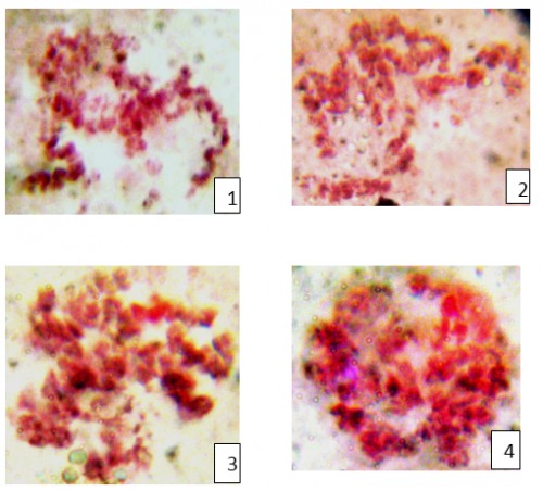 Effects of plant extracts on polytene chromosome 1-Effects of <em>Lantana camara</em> 2-Effects of <em>Thyme vulgaris </em>3-Effects of <em>Catharanthus roseus </em>4-Effects of <em>Moringa oliefera</em>