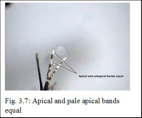 Apical and pale apical bands equal