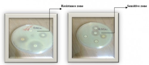 Showing antibiotic resistance and sensitive zone