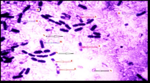 Grams Micrograph, Observe the Para central endospores (E), Bacilli (R) & free spores (S)