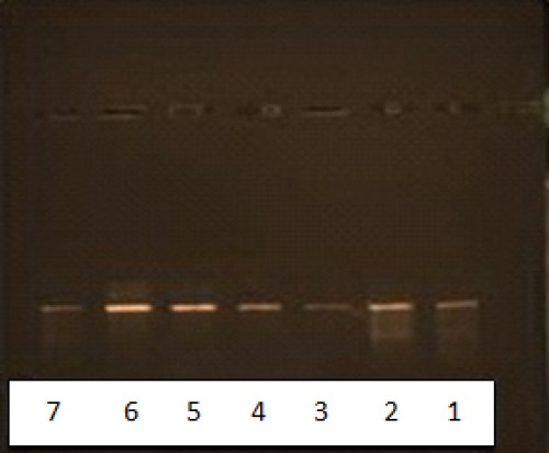 Agarosegel electrophoresis of DNA extracted from cutaneous Leishmaniasis culture. Lanes 1 and 6: L. major, lanes 2, 3, 4 and 5: crithidia fasciculata, lane7: no PCR product