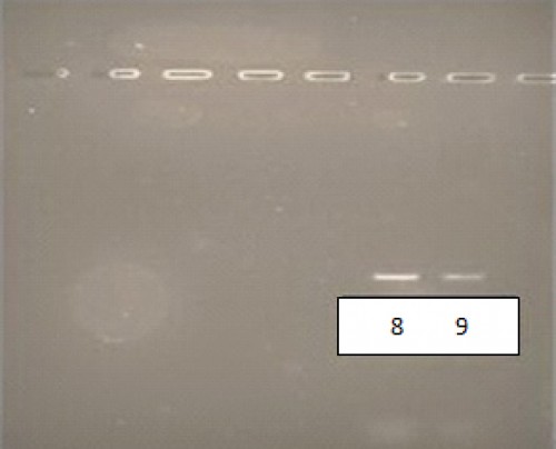 Agarose gel electrophoresis of DNA extracted from cutaneous Leishmaniasis culture. Lanes 8 and 9: L. major