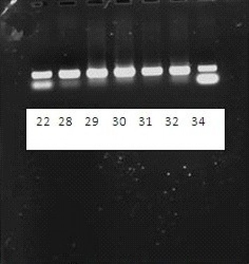 Electrophoresis images of PCR ITS1 products. Lanes 22 and 28: L. major, Lanes 29, 30, 31, and 32: Unnamed Leishmania, lane 34: No similar sample was found.