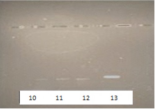 Agarose gel electrophoresis of DNA extracted from cutaneous Leishmaniasis culture. Lane 10: deleted, lanes11 and 12: L. major, lane 13: crithidia fasciculate
