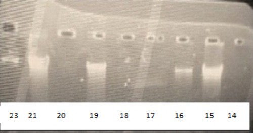 Agarose gel electrophoresis of DNA extracted from cutaneous Leishmaniasis culture.Lanes 14, 15, 16, and 17: Unnamed Leishmania, lanes 18, 19, 20, 21, and 23: L. major.