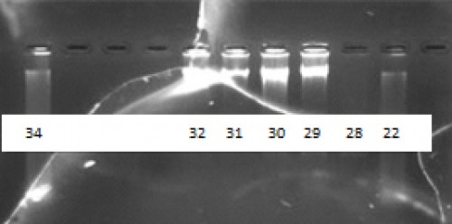 Agarose gel electrophoresis of DNA extracted from cutaneous Leishmaniasis culture .Lanes 22 and 28: L. major, lanes 29, 30, 31, and 32: unnamed Leishmania, lane 34: no similar sample was found.