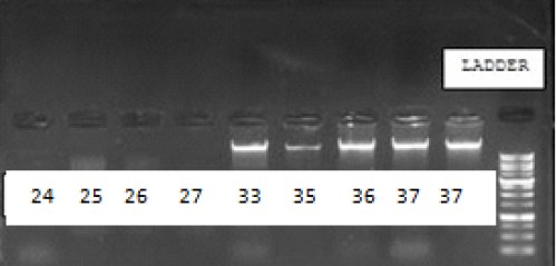 Agarose gel electrophoresis of DNA extracted from cutaneous Leishmaniasis culture. Lanes 24, 25, 26, 27, and 33: unnamed Leishmania, Lanes35, 36, (2) 37: L. major.