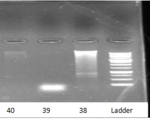 Agarose gel electrophoresis of DNA extracted from cutaneous Leishmaniasis culture. Lanes 38 and 39: Negative for Leishmania, lane 40: L. major.