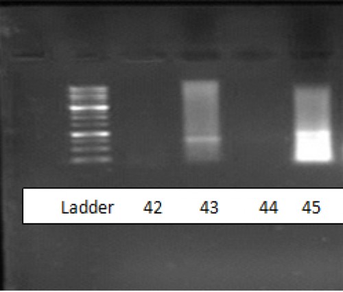 Agarose gel electrophoresis of DNA extracted from cutaneous Leishmaniasis culture .Lane 42: L. major, Lanes 43 and 44: unnamed Leishmania, Lane 45: L.tropica.