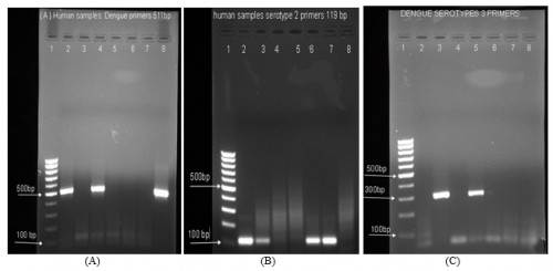 (A) Agarose gel electrophoresis of RT-PCR using D1-D2 primers. Lane 1: 100bp ladder, lane 2: positive control, lane 3, 5, 6 and 7 negative samples, land 4 and 8 positive samples. (B) Agarose gel electrophoresis of nested PCR using D1-TS2 primers. Lane 1: 100bp ladder, lane 2: positive control, lane 3, 6 and 7 positive samples, land 4, 5 and 8 negative samples. (C) Agarose gel electrophoresis of nested-PCR using D1-TS32 primers. Lane 1: 100bp ladder, lane 2: negative control, lane 3: positive control, lane 4, 6, 7and 8 negative samples, land 5 positive samples.