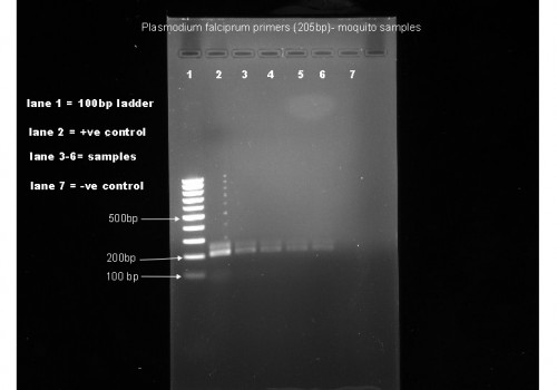 Stained agarose gel for the detection of sporozoite in <em>A. dthali</em>.