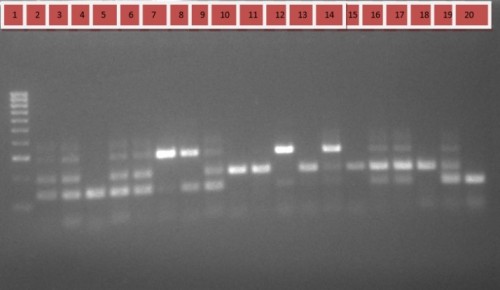 PCR products obtained using the AS (Allele specific) -PCR on Deltamethrin suceptible <em>An. gambiae s.l</em> after separation on a 2% agarose gel. Lane 1: 1000 bp DNA ladder Lane 4, 7,8 12and 20: homozygous wild type mosquitoes (L1014L/L1014L) (137bp); Lane 2, 3, 5,6,,9,13,14,16,17 and 19 heterozygous specimens (L1014L/ L1014F) (195/137bp); Lane 10,11,15 and 18: homozygous resistant specimen (L1014F/ L1014F) (195bp).