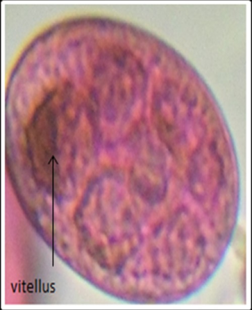 Follicle at stage II-young (40X) (CREC, 2013)