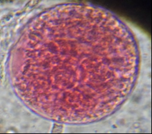 Follicle at stage II-young (40X) (CREC, 2013)